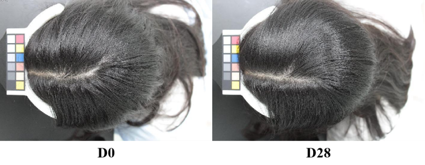 Scalp,health,Cosmetc,Efficacy,Evaluation