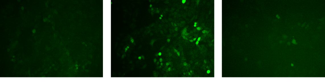 化妝品,抗氧化,抗衰,氧化還原反應(yīng),皮膚,ROS